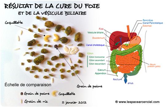 Résultats de la cure du Foie et de la Vésicule Biliaire :-)